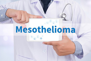 Mesothelioma-causes-Symptoms-Treatment 