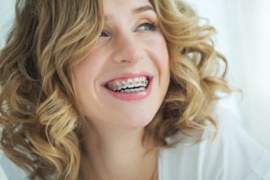 Myths about orthodontic treatment