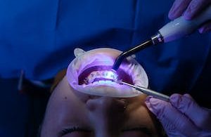 Innovative Dental Treatments for Tooth Decay: A Comprehensive Guide