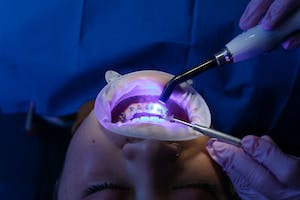 Innovative Dental Treatments for Tooth Decay: A Comprehensive Guide