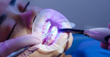 Orthodontic Emergencies